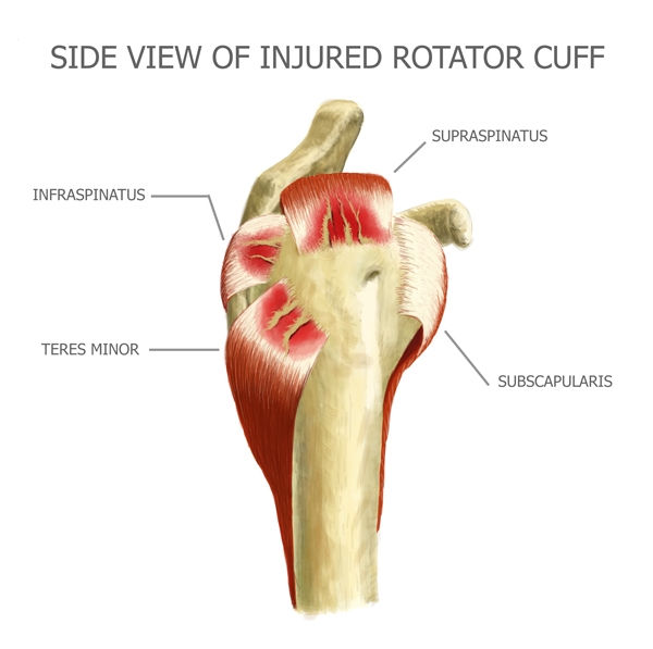 Rotator Cuff Side View